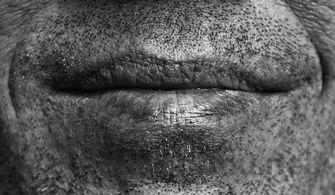 猫咪左边嘴角有点流口水嘴巴肿胀怎么弄会好?